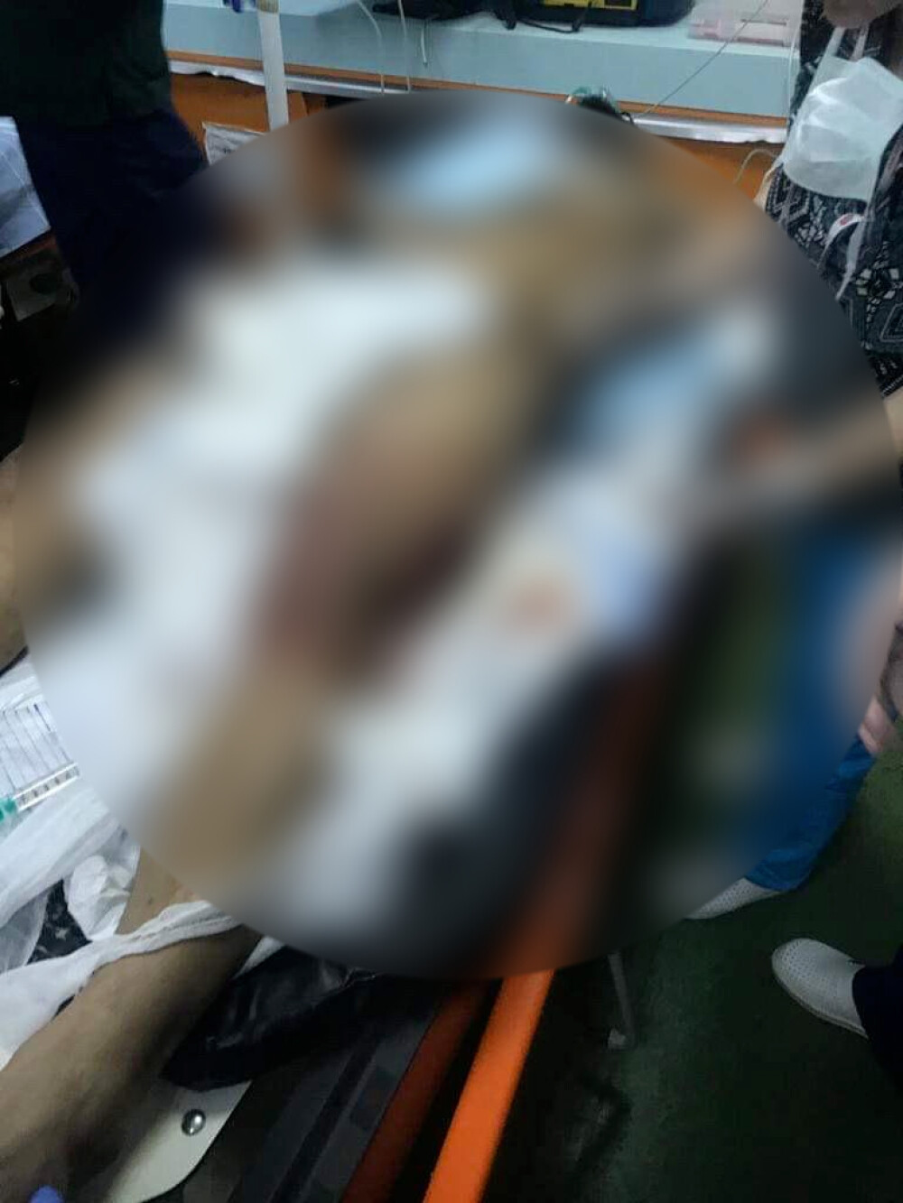 Imagini șocante cu interlopul Bebino, internat în spital după ce fost mutilat de un rival - Imaginea 4