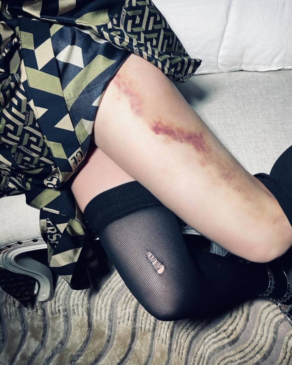 FOTO Madonna și-a desfăcut picioarele în fața camerei pentru a arăta o vânătaie. „M-a bătut viața” - Imaginea 8