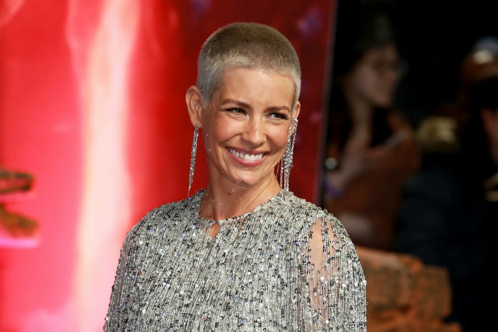 Actrița Evangeline Lilly, cunoscută din Marvel, are leziuni cerebrale după ce a căzut și s-a lovit cu capul de o piatră - Imaginea 4