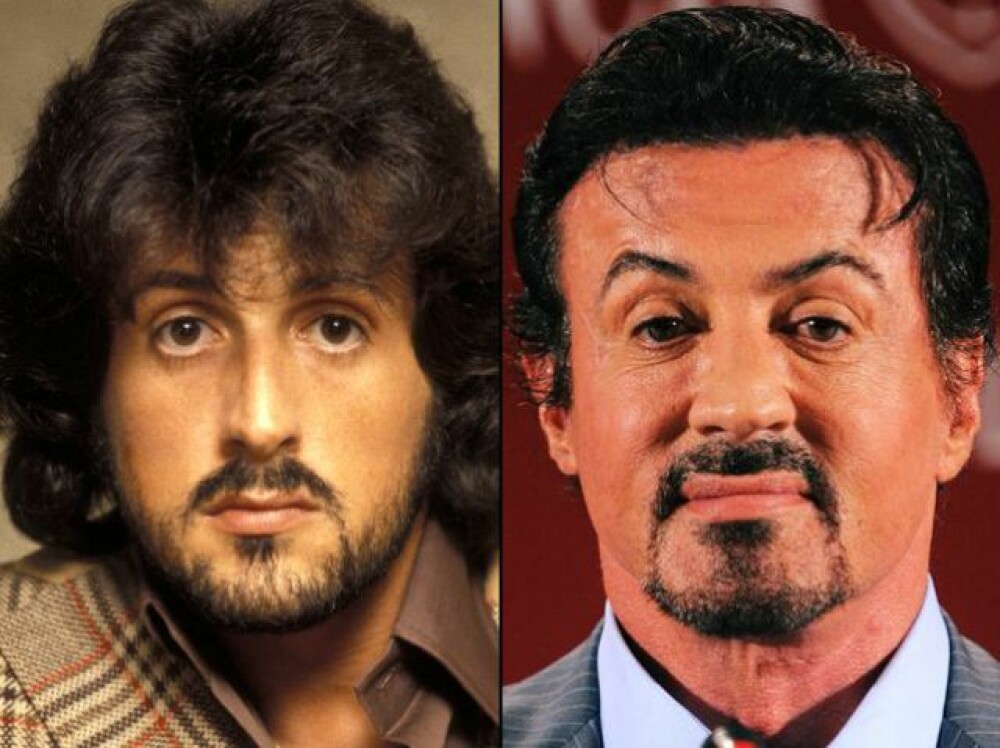 Asa mama, asa fiu!Jackie si Sylvester Stallone, fideli operatiilor estetice - Imaginea 6