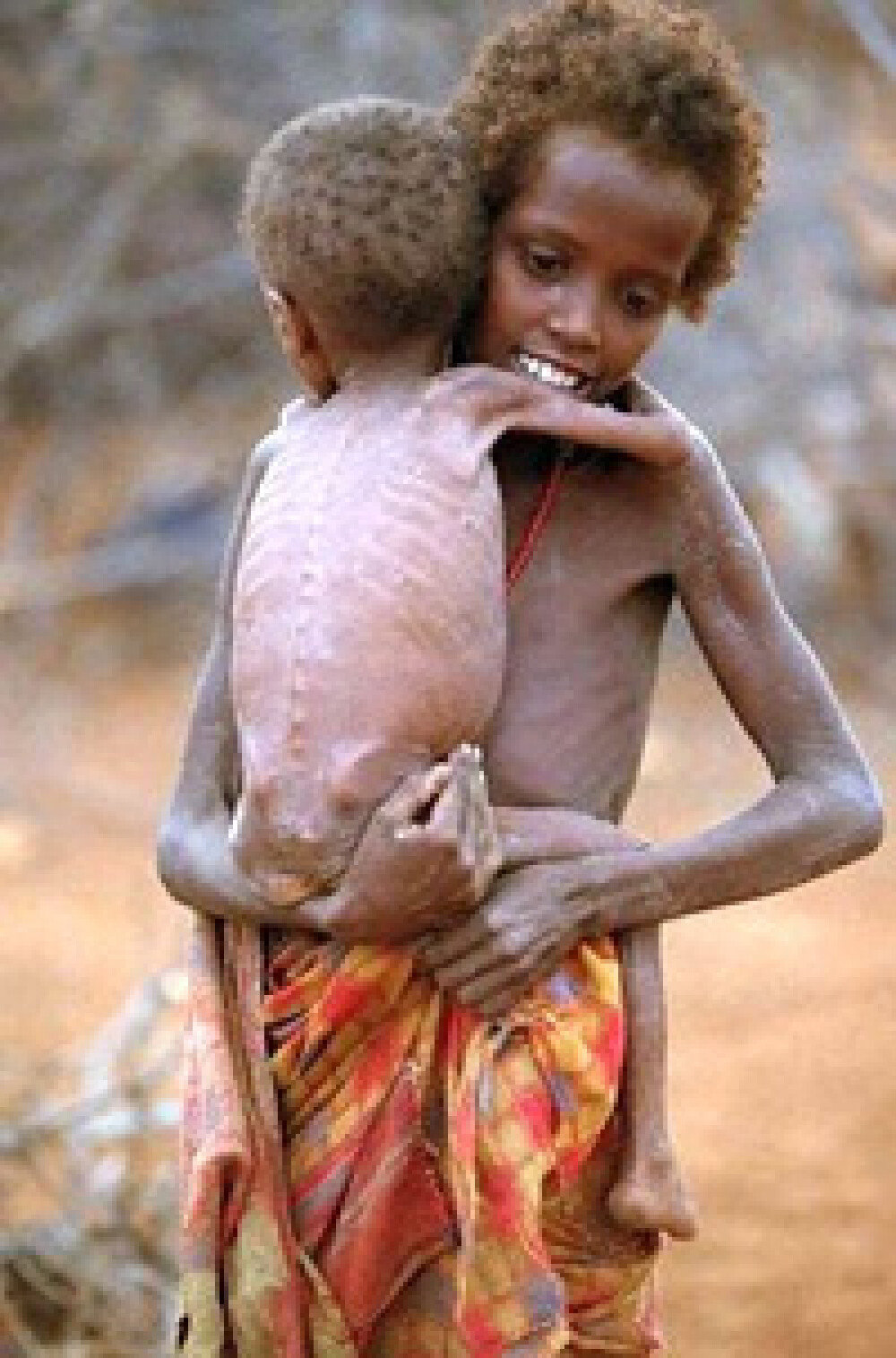 Catastrofa umanitara. Tara unde ONU declara foametea pentru prima oara in ultimii 30 de ani - Imaginea 1