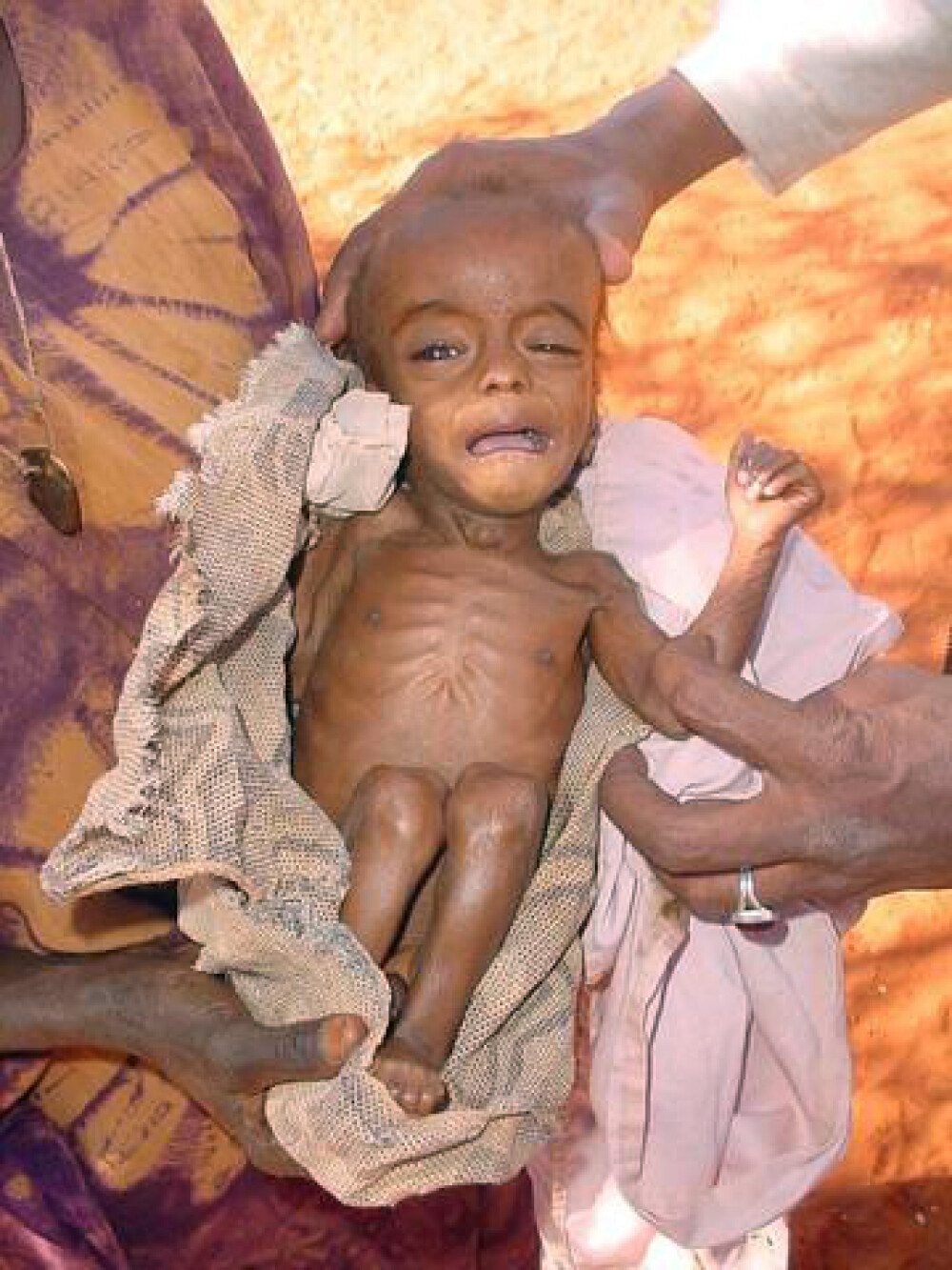 Catastrofa umanitara. Tara unde ONU declara foametea pentru prima oara in ultimii 30 de ani - Imaginea 2