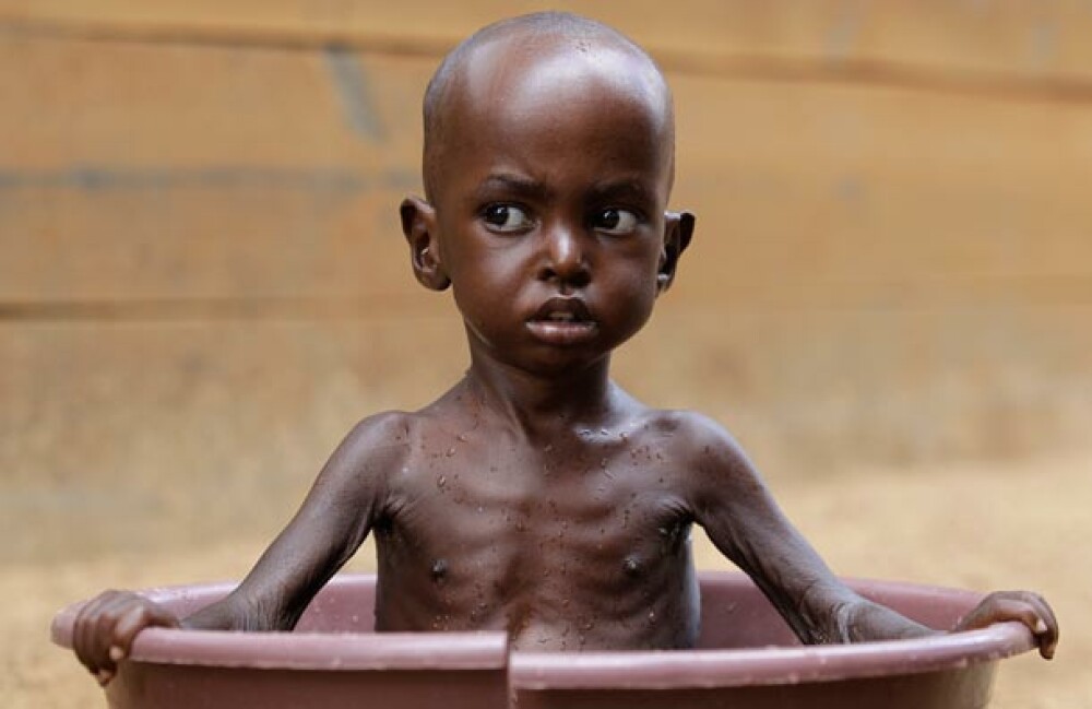 Catastrofa umanitara. Tara unde ONU declara foametea pentru prima oara in ultimii 30 de ani - Imaginea 4