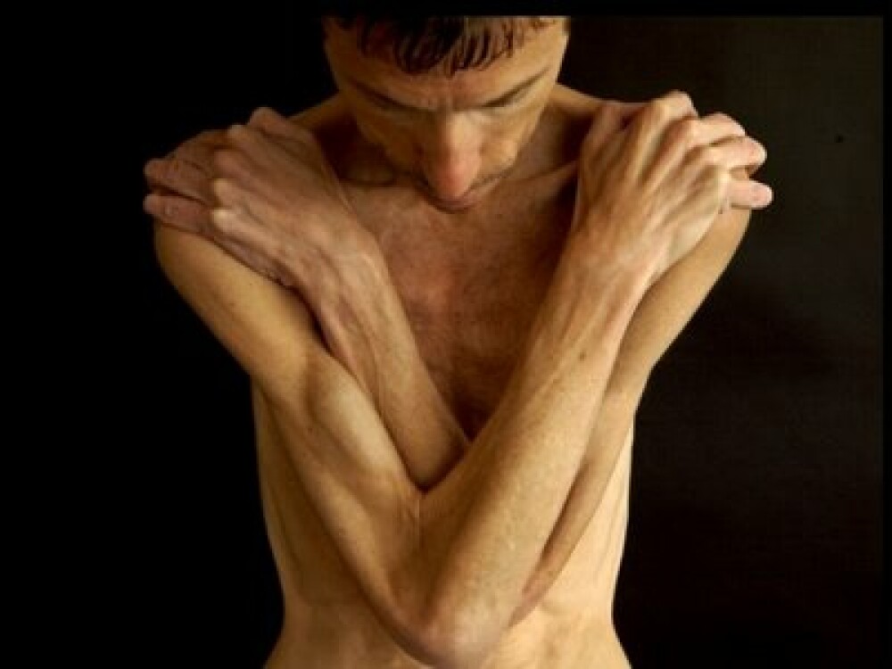Anorexia nu mai e doar o boala a femeilor. Tot mai multi barbati se infometeaza. GALERIE FOTO - Imaginea 4