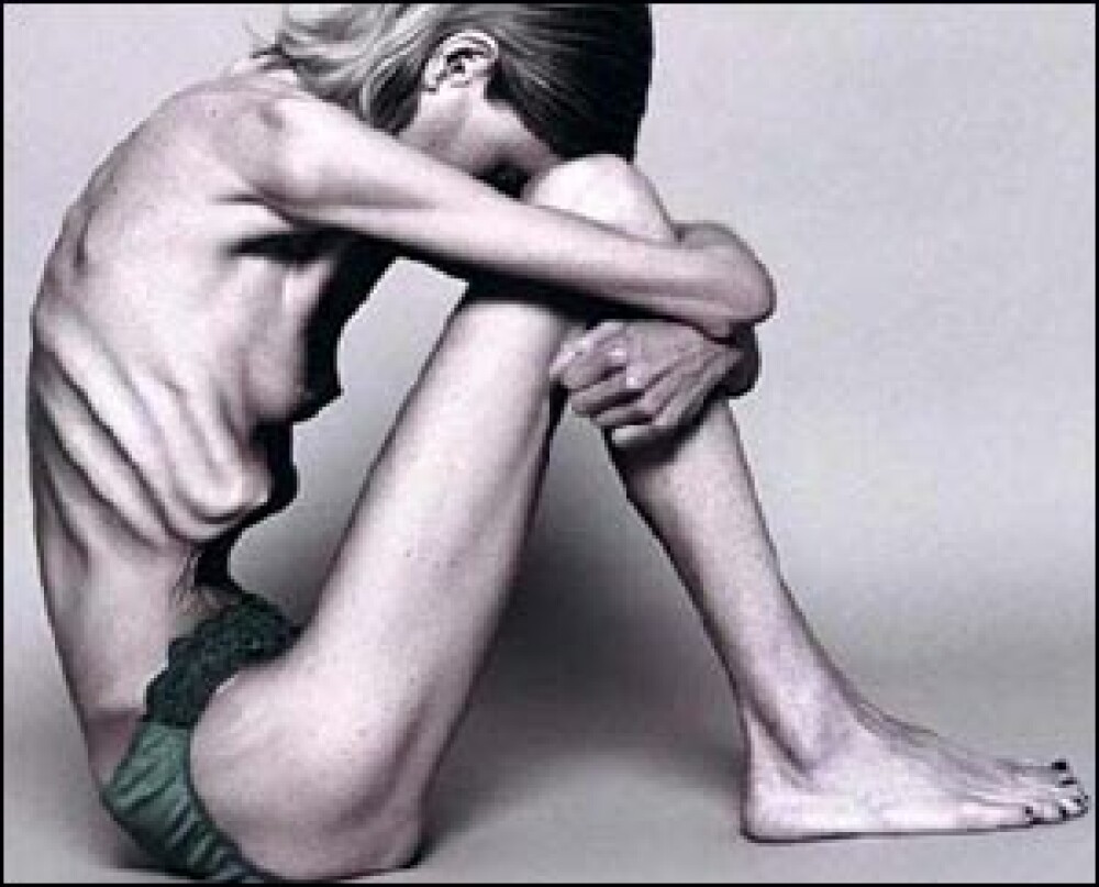 Sotia Printului William, pe site-urile care indeamna la anorexie si bulimie - Imaginea 2