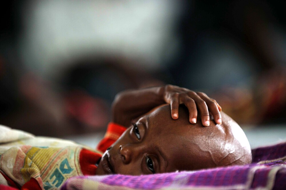 Catastrofa umanitara. Tara unde ONU declara foametea pentru prima oara in ultimii 30 de ani - Imaginea 6