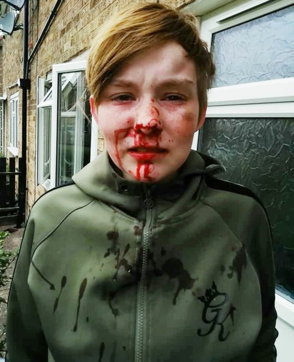 Tânără de 18 ani snopita în bătaie în plină strada pentru că era lesbiană. Cine sunt agresorii - Imaginea 2