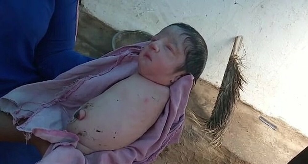 O fetiță s-a născut fără mâini și fără picioare. Medicii au rămas uimiți - Imaginea 1