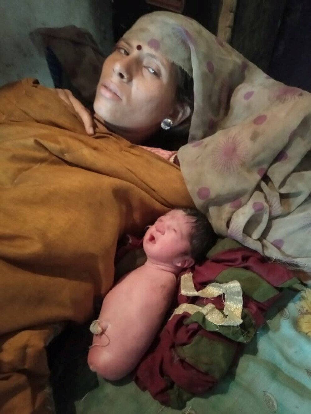 O fetiță s-a născut fără mâini și fără picioare. Medicii au rămas uimiți - Imaginea 3