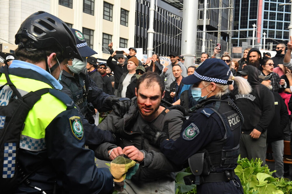 Proteste violente în Australia, din cauza restricțiilor Covid-19. Țara, afectată de Delta - Imaginea 4