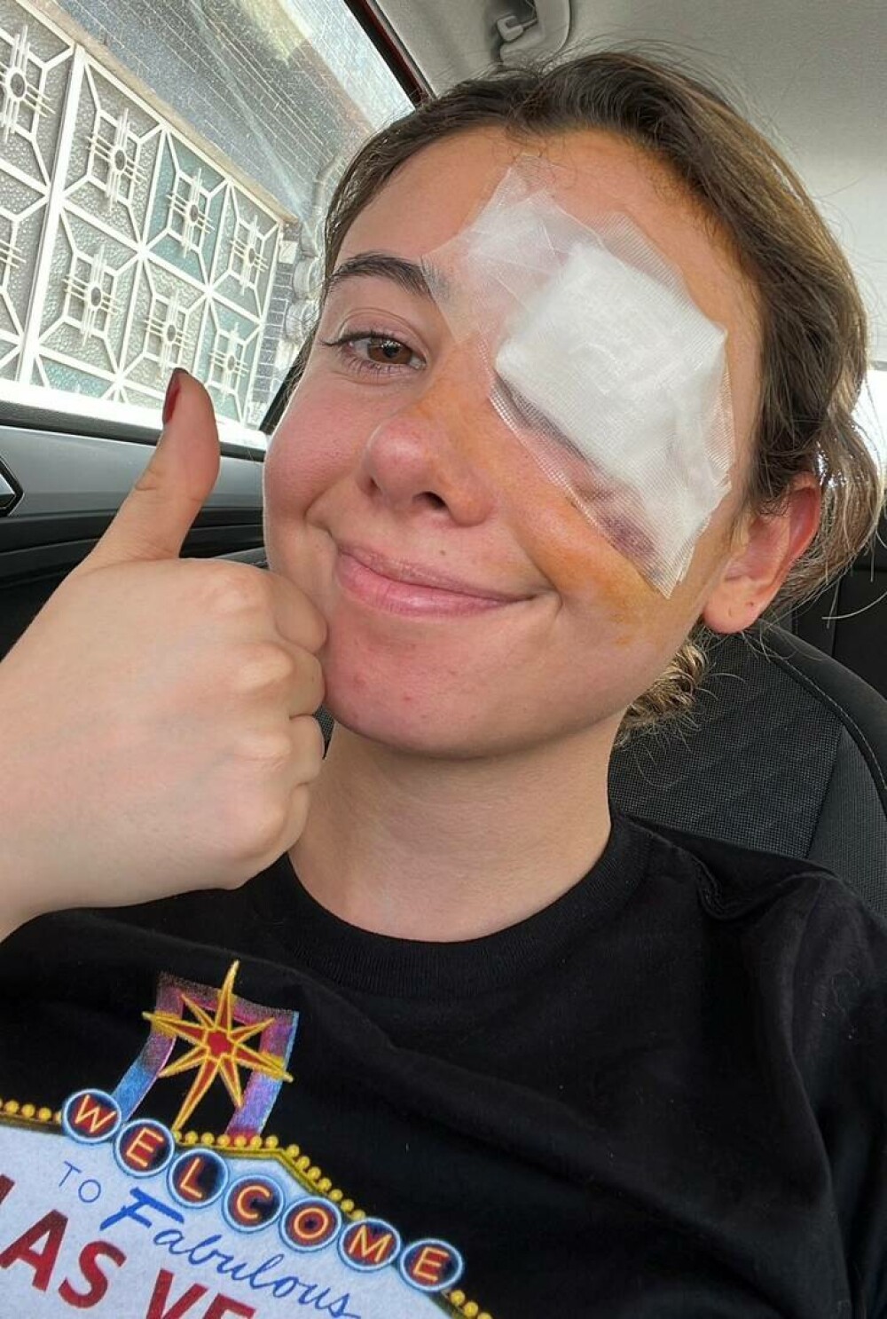 O tânără a fost nevoită să se opereze la ochi după ce a urmat un sfat de demachiere văzut pe Internet - Imaginea 5