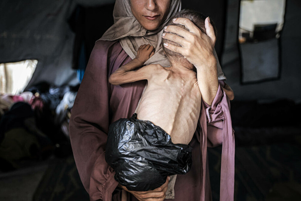 Raport ONU: Cel mai grav scenariu de foamete se desfăşoară acum în Gaza. Situația umanitară a ajuns într-un punct critic - Imaginea 8