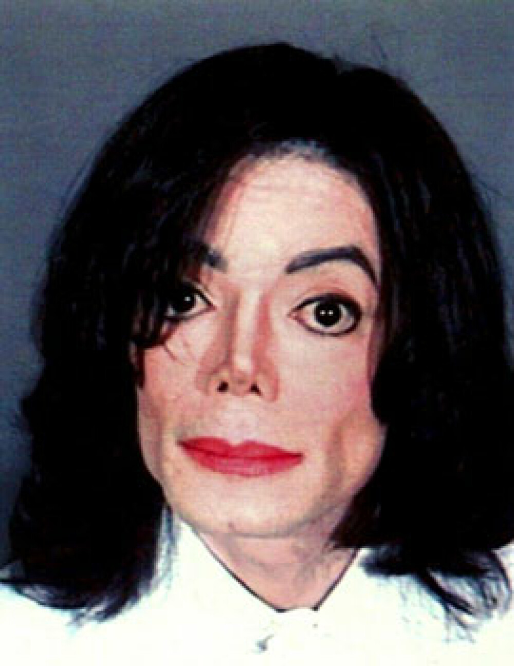 Michael Jackson si permanenta lupta cu boala - Imaginea 15