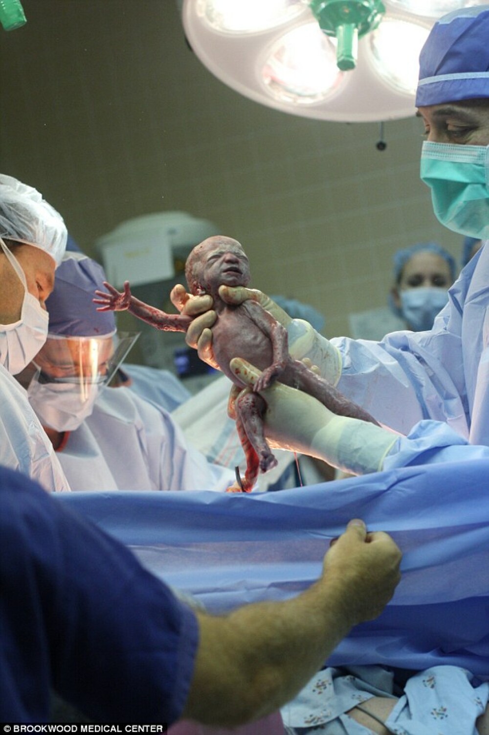 Nastere spectaculoasa in doar 3 minute. 50 de medici, sase bebelusi, o singura mama - Imaginea 2