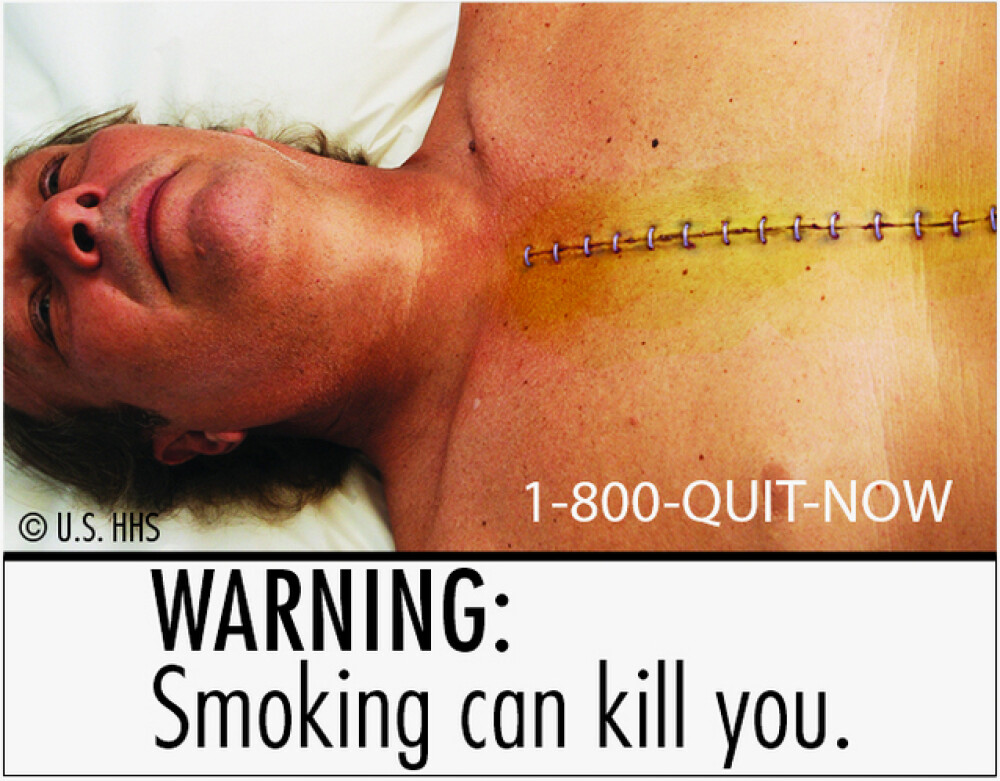 Cum vor americanii sa ii sperie pe fumatori. GALERIE FOTO - Imaginea 7