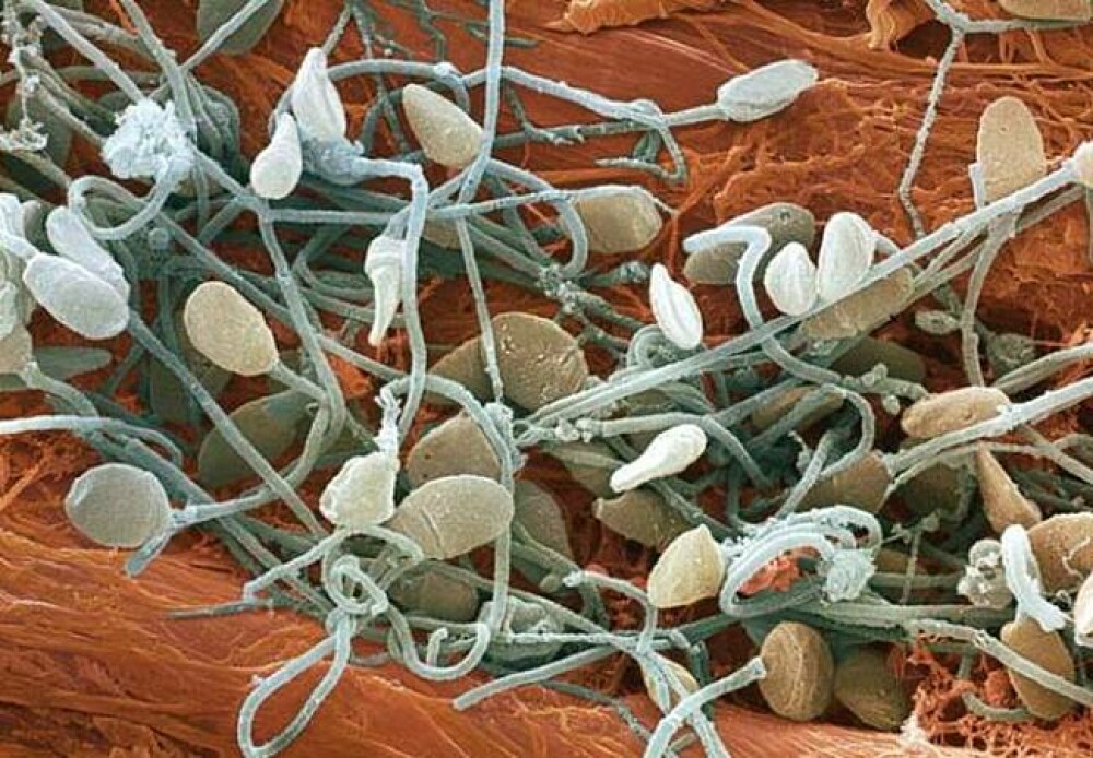 Viata sub lupa. Cum arata genele, spermatozoizii sau firele de par, marite de 1000 de ori. FOTO - Imaginea 1