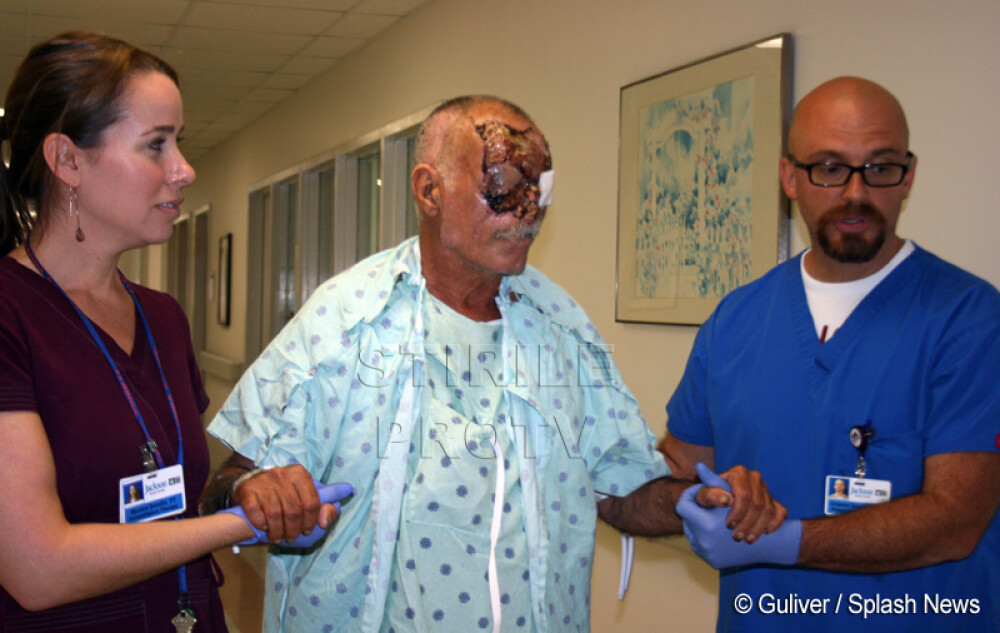 Fotografiat in spital: Primele IMAGINI cu barbatul devorat de canibalul din Miami - Imaginea 4