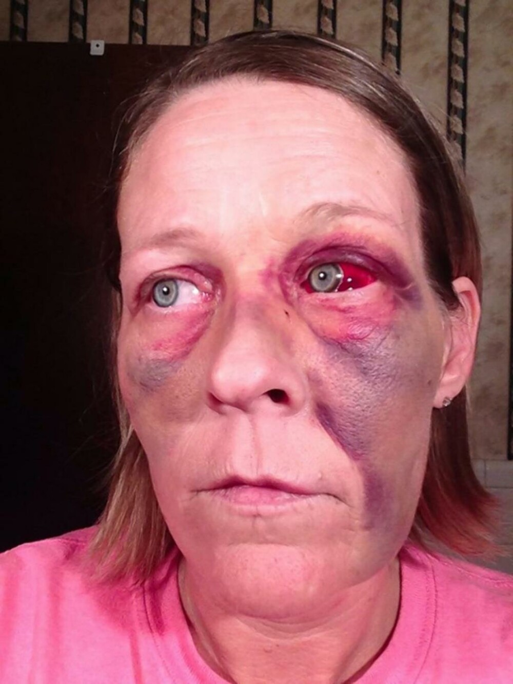 Angela lupta impotriva violentei domestice pe Facebook. Povestile cumplite pe care le spun fotografiile ei - Imaginea 1