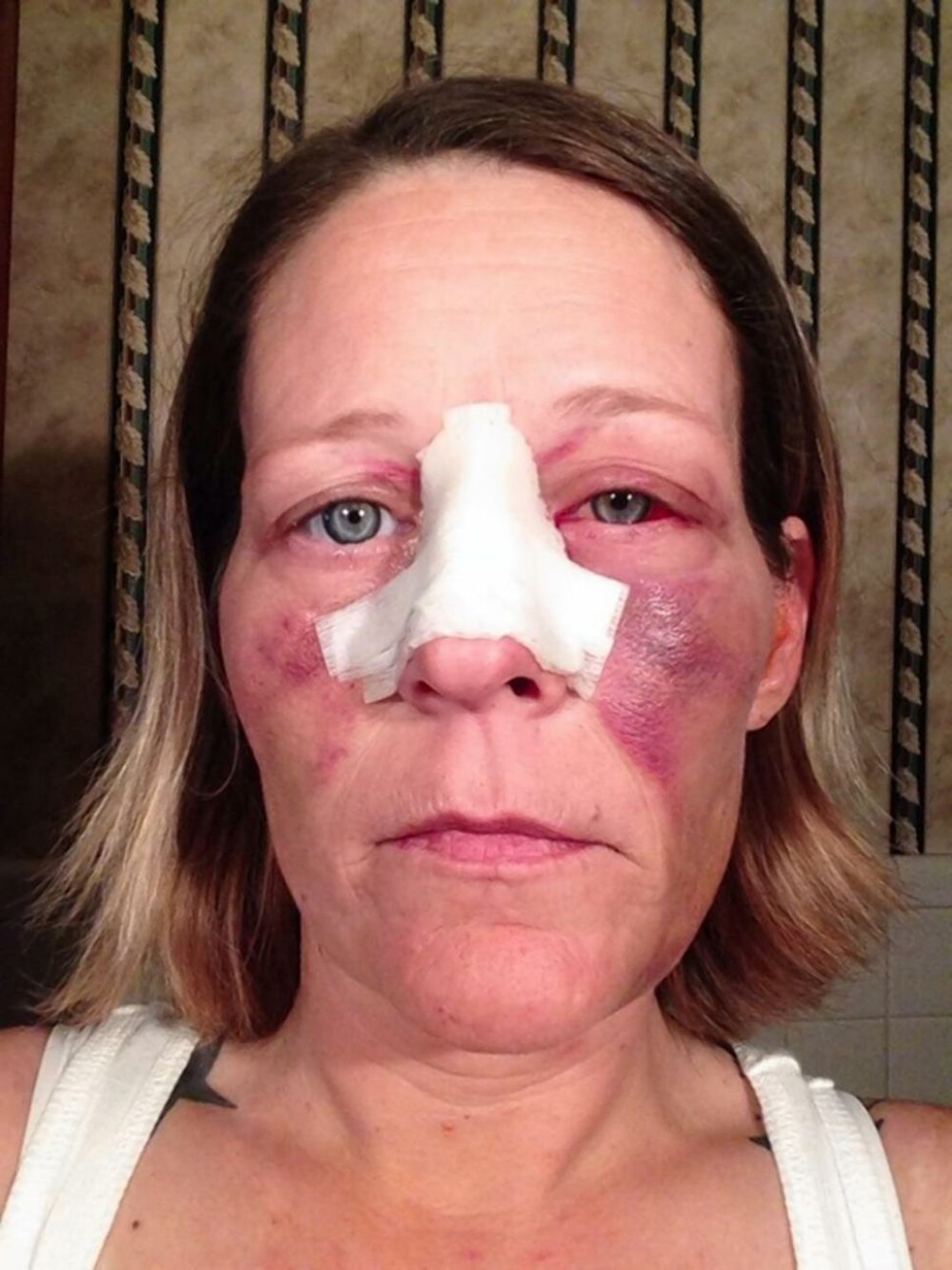 Angela lupta impotriva violentei domestice pe Facebook. Povestile cumplite pe care le spun fotografiile ei - Imaginea 3