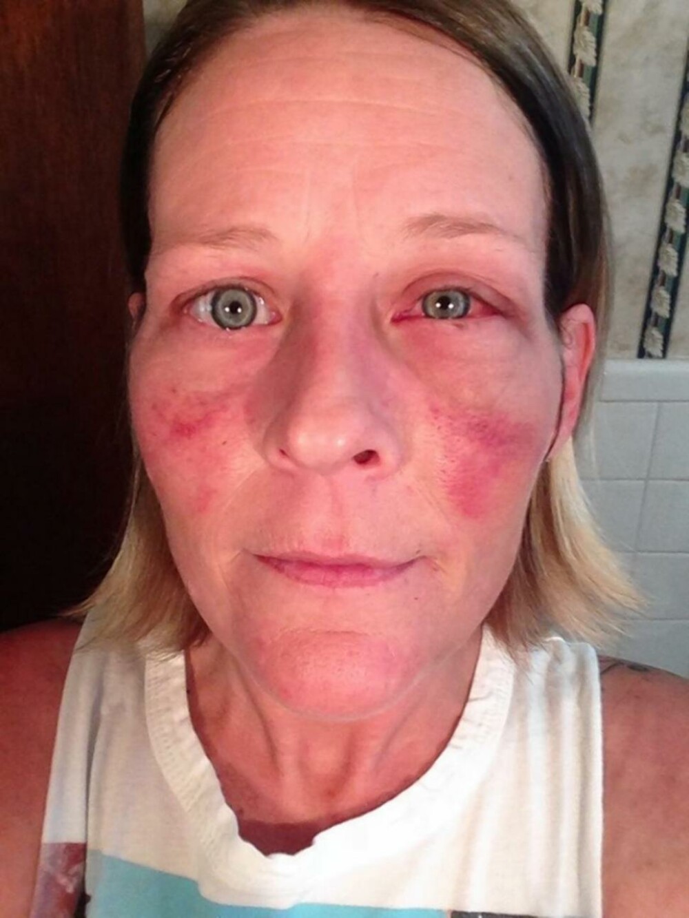 Angela lupta impotriva violentei domestice pe Facebook. Povestile cumplite pe care le spun fotografiile ei - Imaginea 4