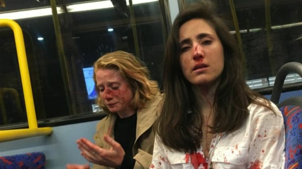 Reacția femeilor bătute brutal pentru că nu s-au sărutat într-un autobuz. Atacatorii, prinși - Imaginea 1