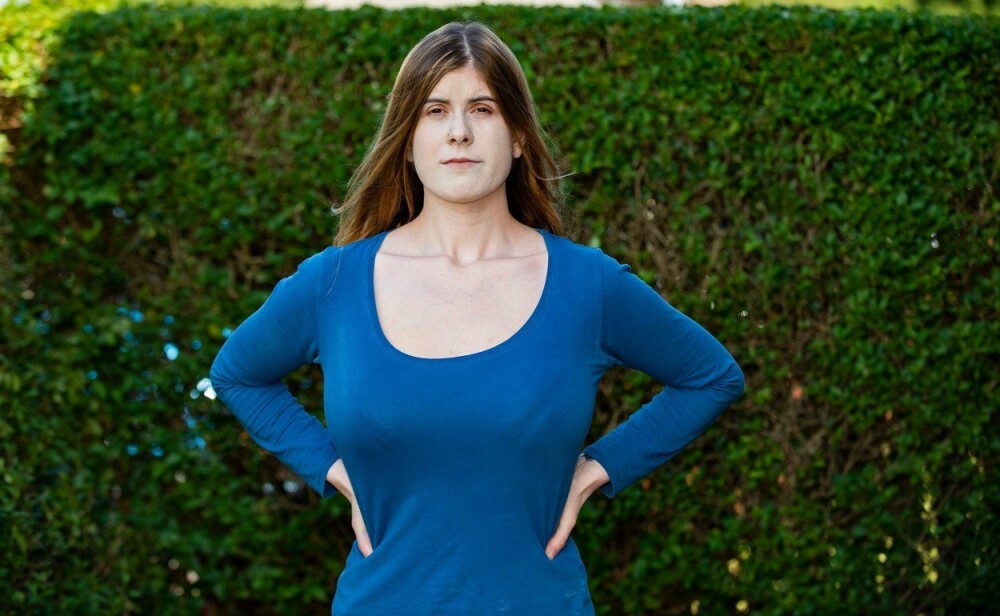Cum arată femeia care le cere oamenilor bani pentru operația de micșorare a sânilor - Imaginea 2