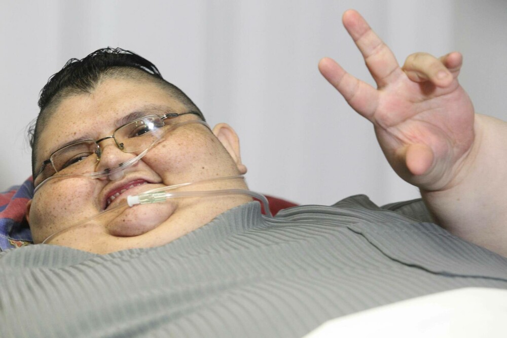 Transformarea incredibilă a celui mai gras om din lume. Cum arată după ce a slăbit 330 de kilograme | FOTO - Imaginea 1