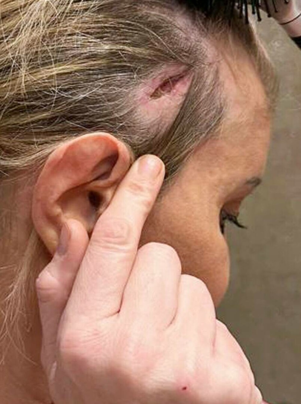 Are o gaură în cap. O celebră actriță a rămas mutilată după operațiile estetice: „M-a cusut cu fire de pescuit” | FOTO - Imaginea 12