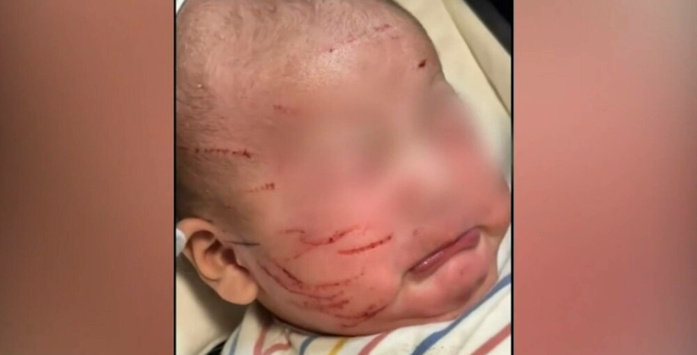 O mamă a rămas îngrozită după ce și-a luat copilul de doar 10 săptămâni de la creșă: „Cum se poate întâmpla asta accidental?” - Imaginea 2