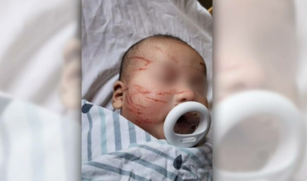 O mamă a rămas îngrozită după ce și-a luat copilul de doar 10 săptămâni de la creșă: „Cum se poate întâmpla asta accidental?” - Imaginea 4