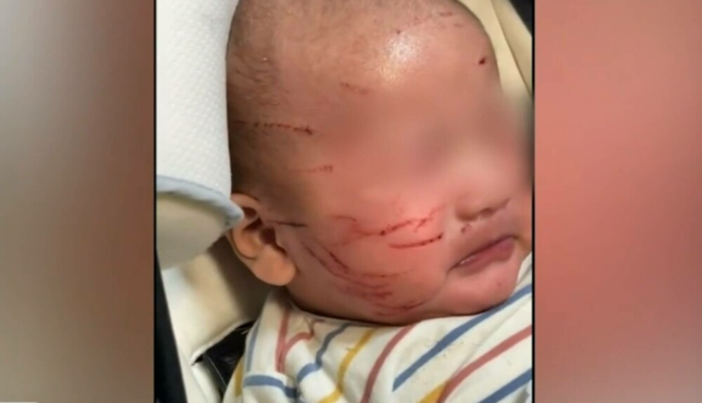 O mamă a rămas îngrozită după ce și-a luat copilul de doar 10 săptămâni de la creșă: „Cum se poate întâmpla asta accidental?” - Imaginea 5