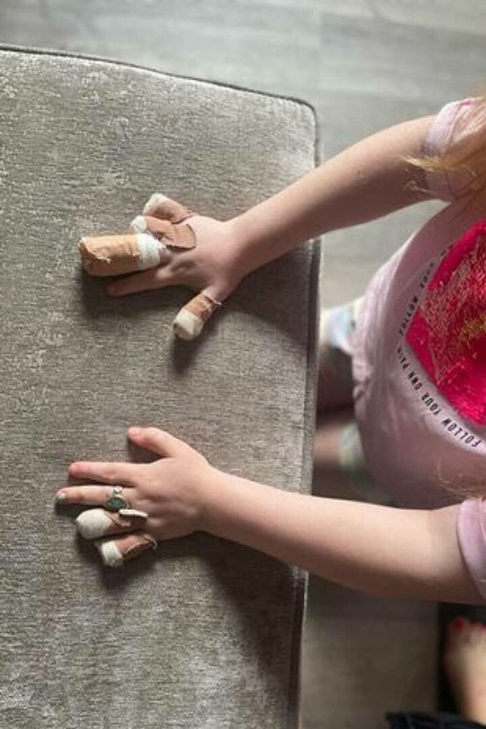 „Este sfâșietor”. O fetiță de 9 ani a rămas fără 6 degete de la mâini, după ce s-a accidentat în timp ce se juca - Imaginea 4