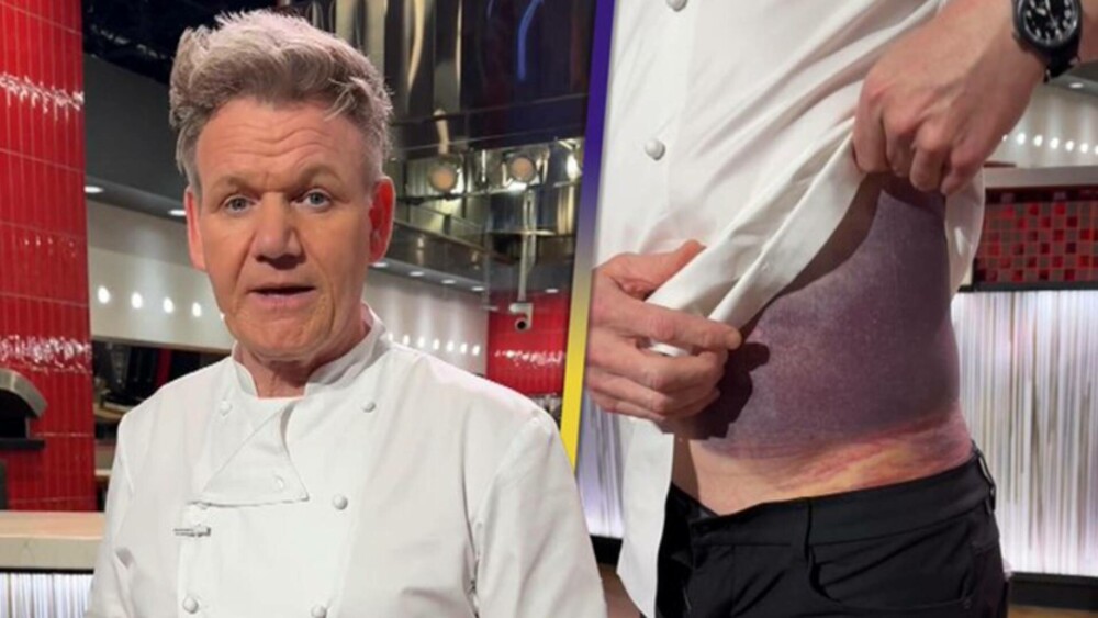 Gordon Ramsay dezvăluie că a avut un accident grav de bicicletă în SUA. Ce le-a transmis fanilor. FOTO - Imaginea 1