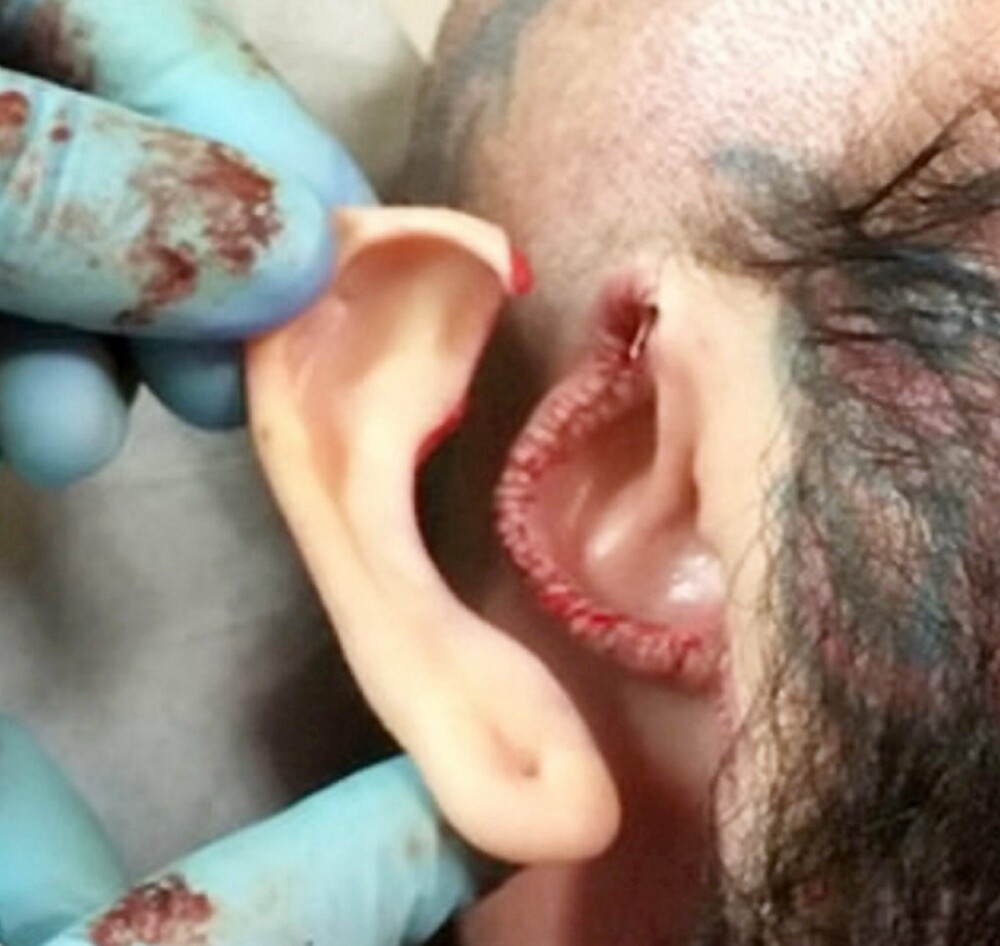 Sentința primită „Dr. Evil”, tatuatorul care își desfigura clienții. Cum arată victimele - Imaginea 2