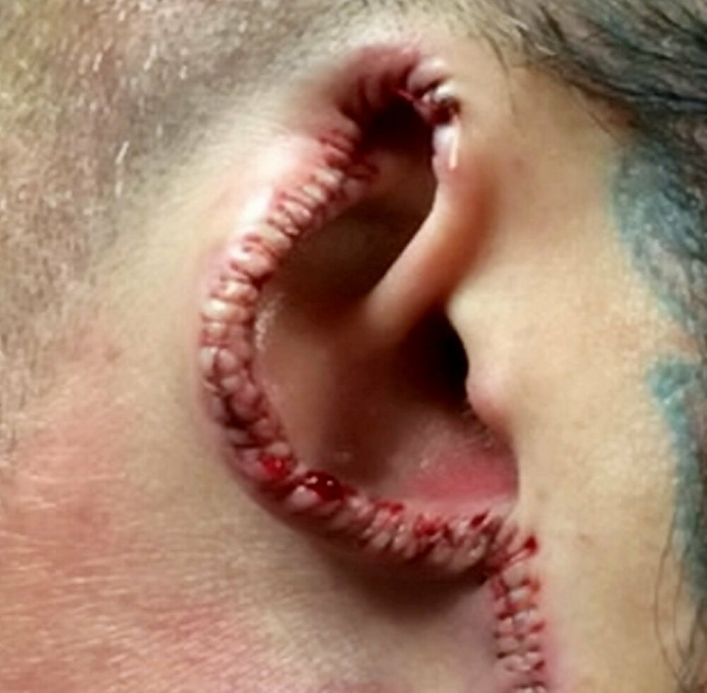 Sentința primită „Dr. Evil”, tatuatorul care își desfigura clienții. Cum arată victimele - Imaginea 1