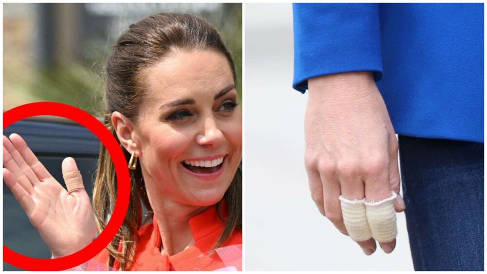 Motivul pentru care prințesa de Wales apare mereu cu degetele bandajate. Ce probleme de sănătate ar mai avea Kate - Imaginea 13