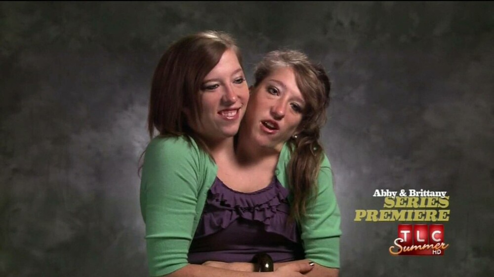 Geamăna siameză Abby Hensel s-a căsătorit. Imagini cu ea și sora Brittany în rochie de mireasă | FOTO & VIDEO - Imaginea 12