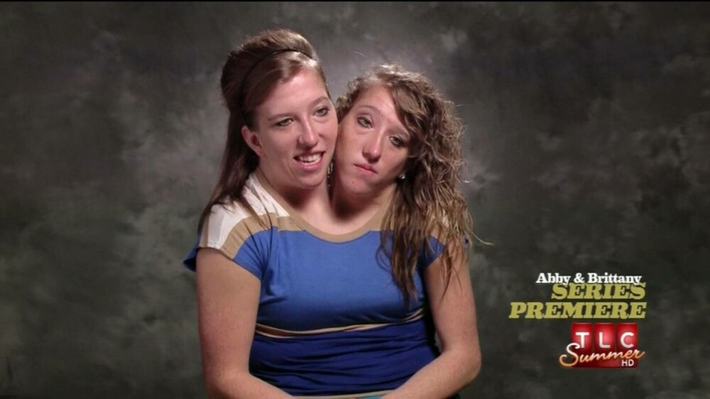 Geamăna siameză Abby Hensel s-a căsătorit. Imagini cu ea și sora Brittany în rochie de mireasă | FOTO & VIDEO - Imaginea 14