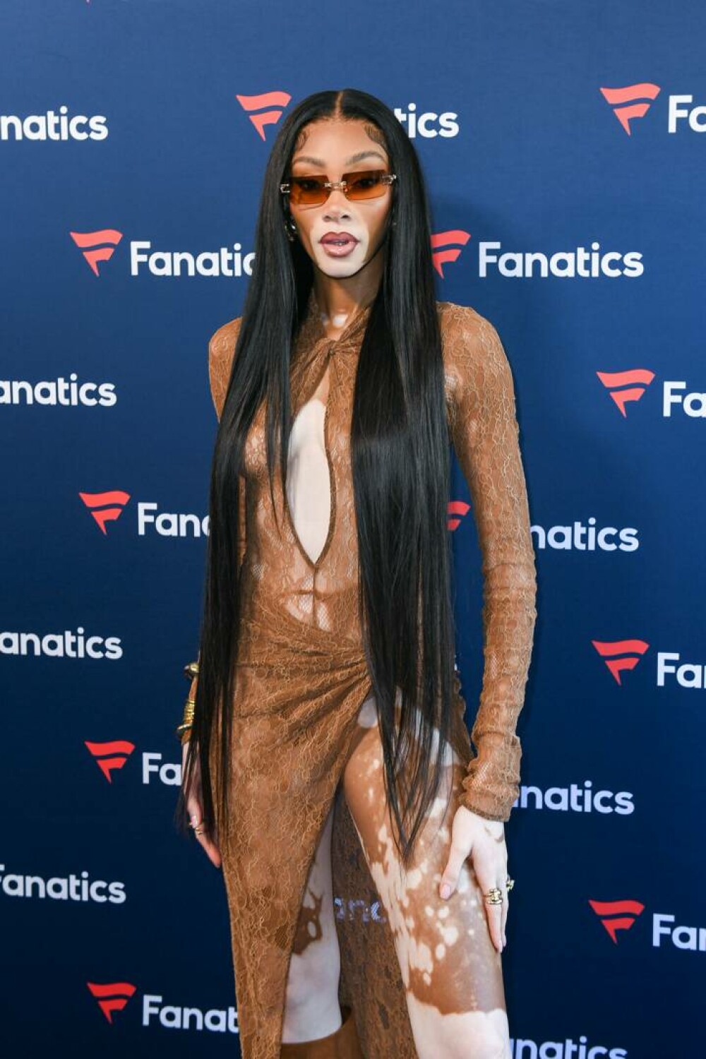 Modelul Winnie Harlow, apariție spectaculoasă pe străzile din Miami alături de cățelul ei | GALERIE FOTO - Imaginea 13