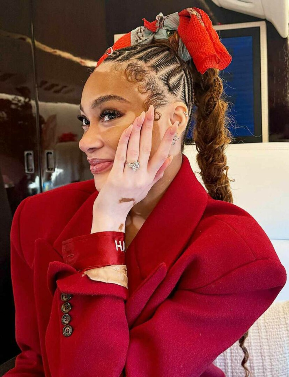 Modelul Winnie Harlow, apariție spectaculoasă pe străzile din Miami alături de cățelul ei | GALERIE FOTO - Imaginea 8