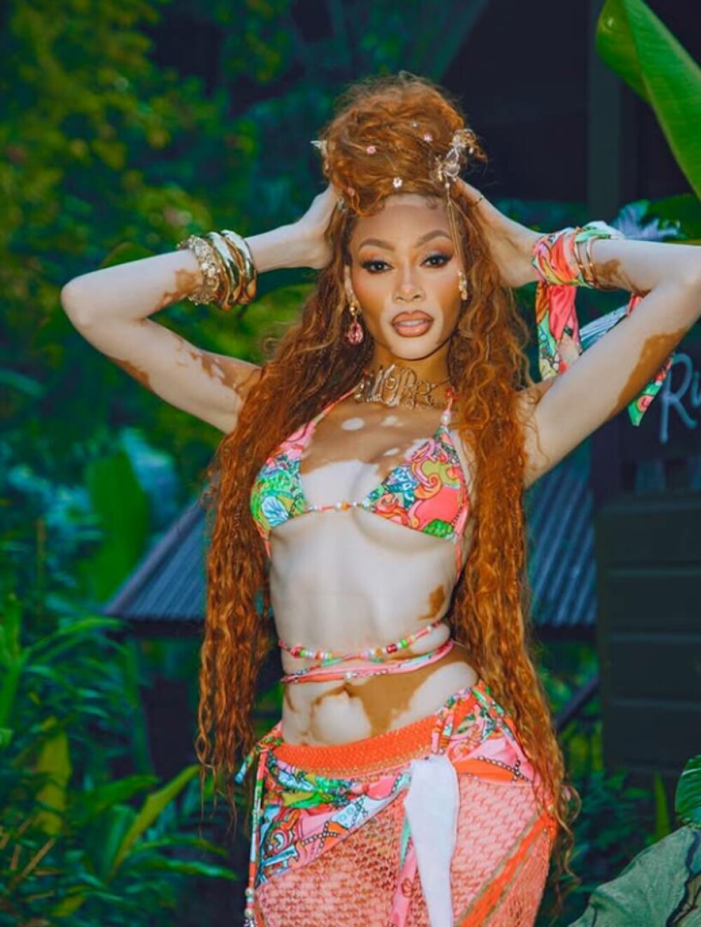 Modelul Winnie Harlow, apariție spectaculoasă pe străzile din Miami alături de cățelul ei | GALERIE FOTO - Imaginea 20