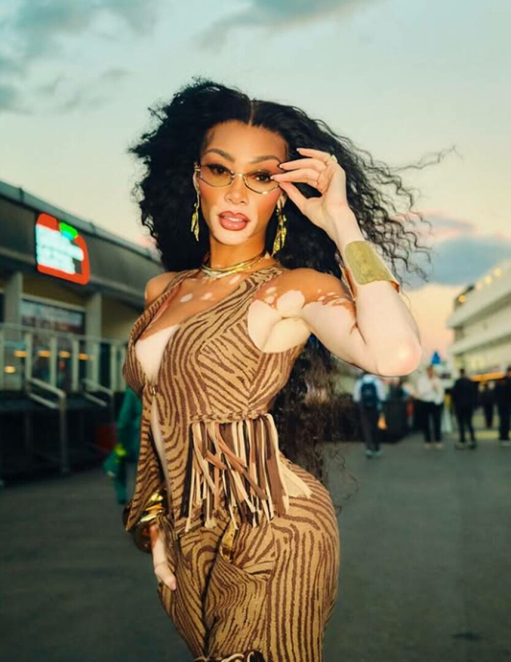 Modelul Winnie Harlow, apariție spectaculoasă pe străzile din Miami alături de cățelul ei | GALERIE FOTO - Imaginea 22