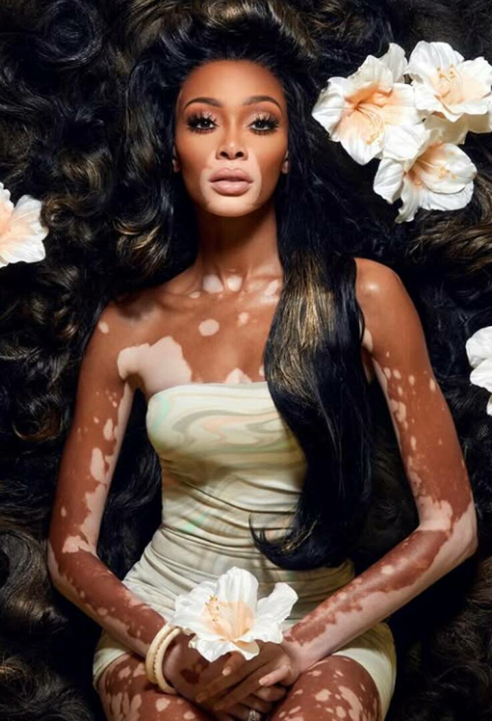 Modelul Winnie Harlow, apariție spectaculoasă pe străzile din Miami alături de cățelul ei | GALERIE FOTO - Imaginea 26