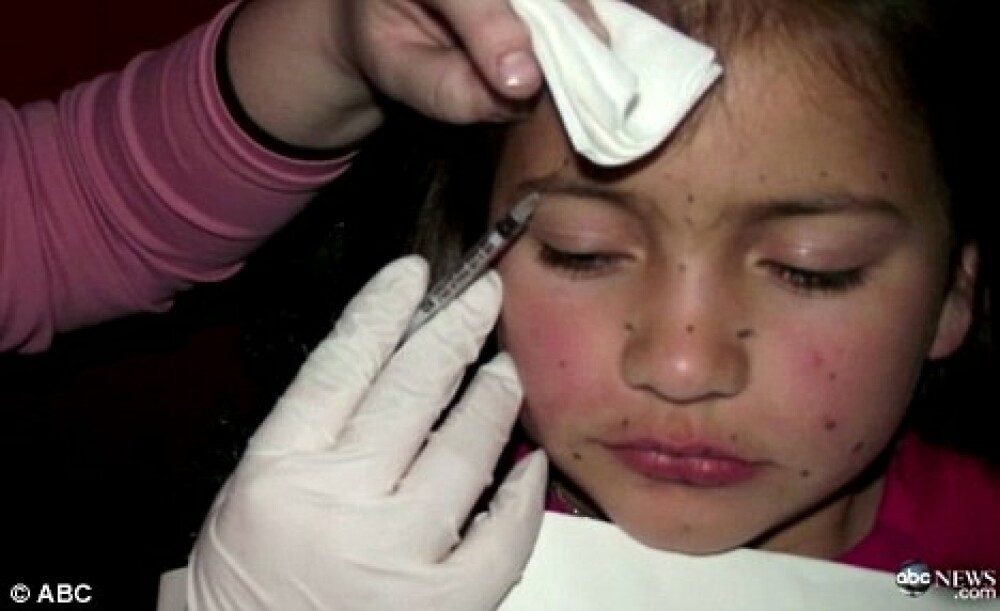 Soc in SUA. O fetita de 8 ani, injectata cu botox pentru un concurs. FOTO - Imaginea 1