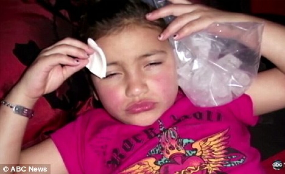 Soc in SUA. O fetita de 8 ani, injectata cu botox pentru un concurs. FOTO - Imaginea 3