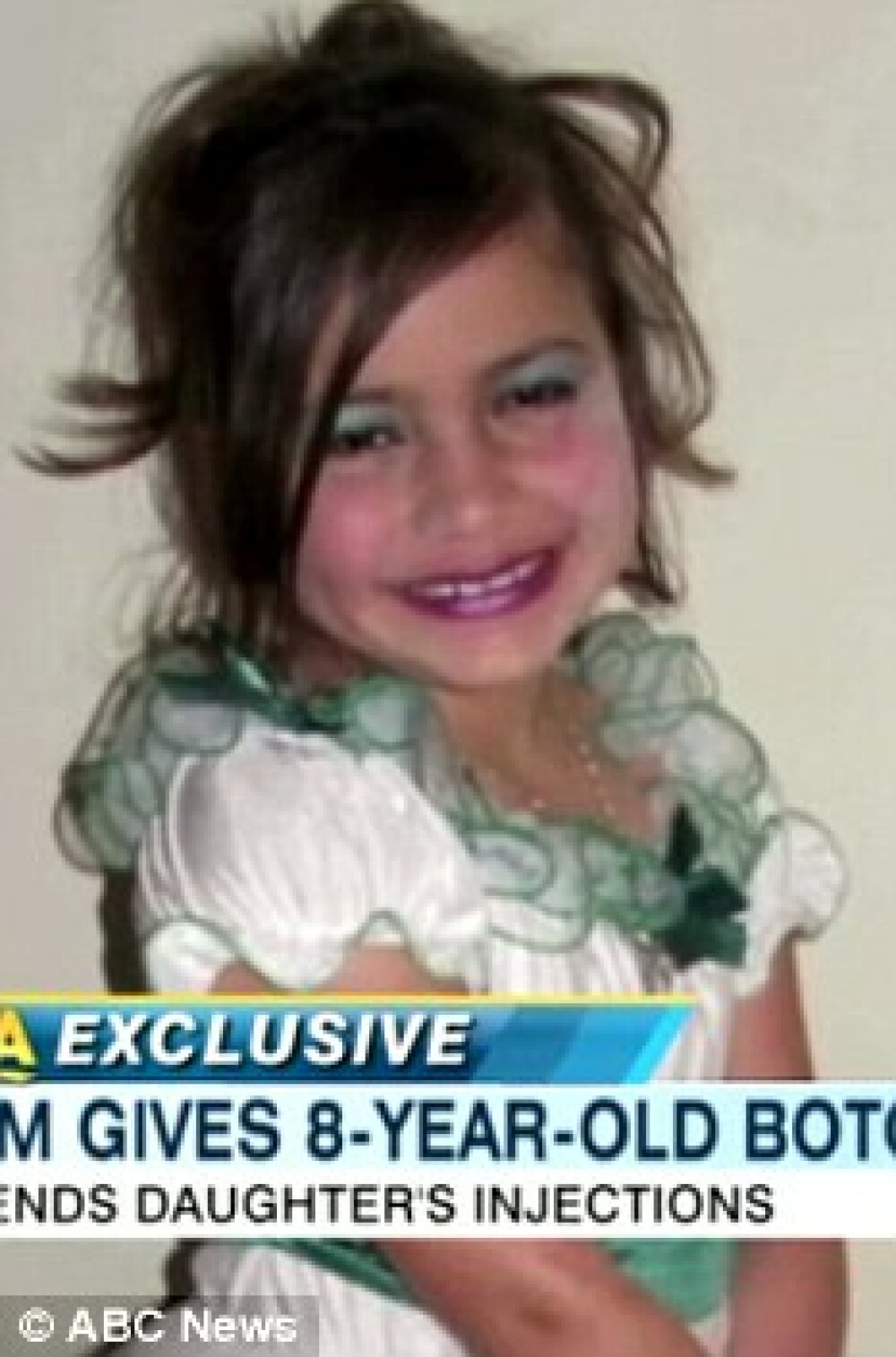 Soc in SUA. O fetita de 8 ani, injectata cu botox pentru un concurs. FOTO - Imaginea 5