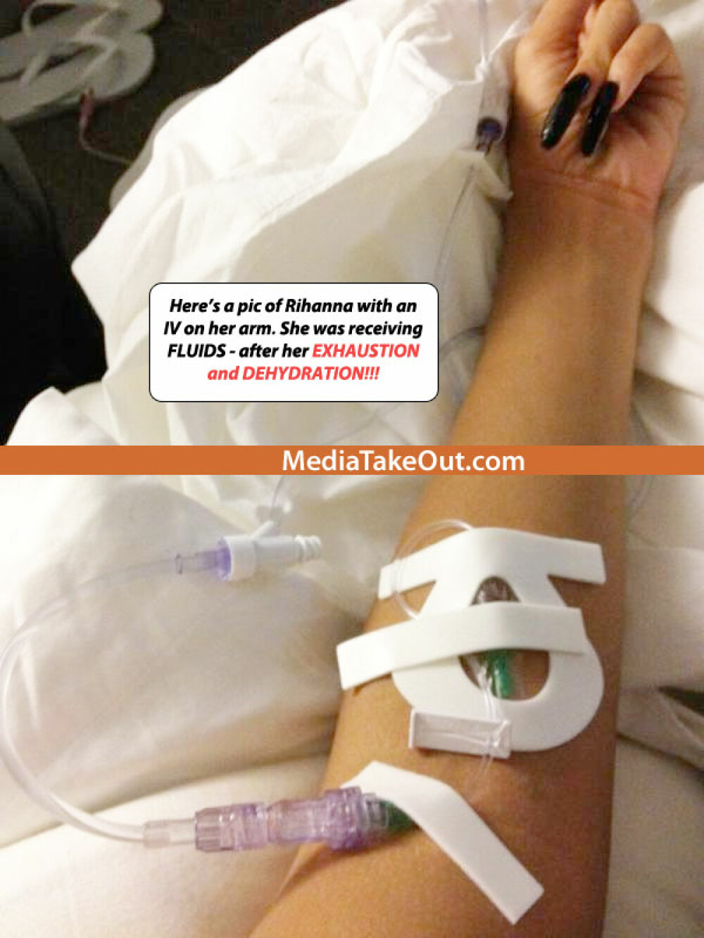 Medicii pentru National Enquirer: “Rihanna ar putea sa moara maine din cauza insuficientei hepatice” - Imaginea 1