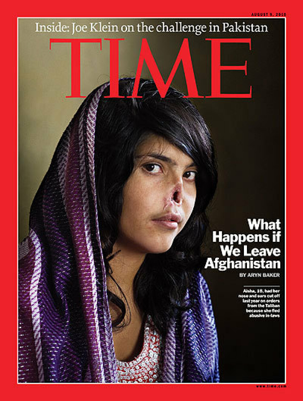 A schimbat imaginea unui razboi, viata a 15 milioane de femei, azi traieste asa si refuza o operatie - Imaginea 3