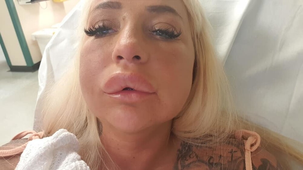O actriță de filme pentru adulți a fost mutilată în urma unor proceduri cosmetice - Imaginea 21