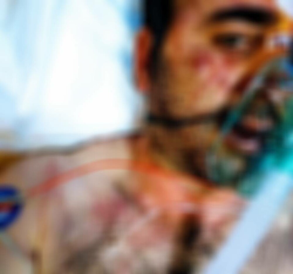Mesajul unui italian desfigurat de 3 țigani, care l-au bătut cu pumnii și picioarele. FOTO - Imaginea 1